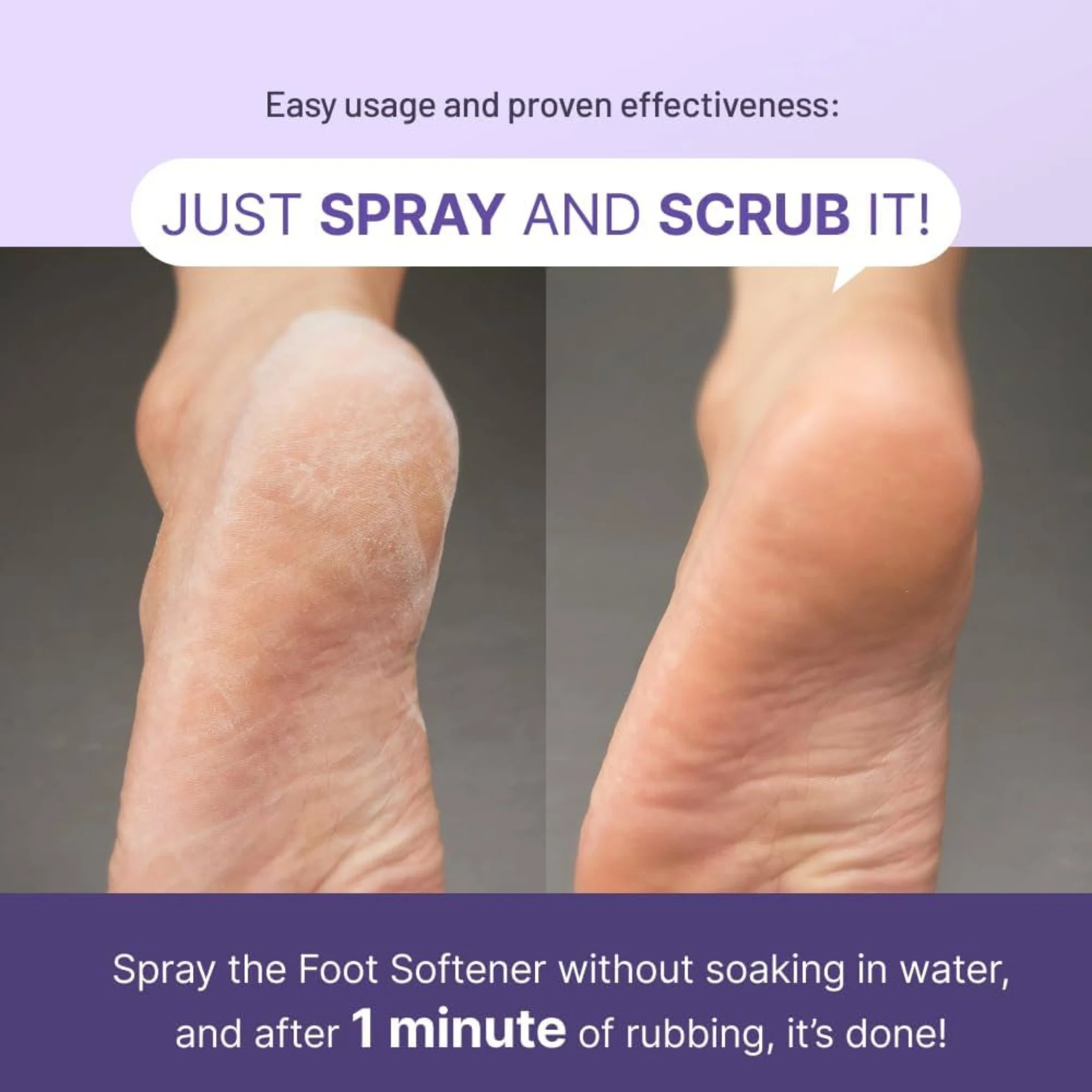 BAREN Callus Remover Kit for Feet: Foot File & Peeling Foot Spray - Image 4