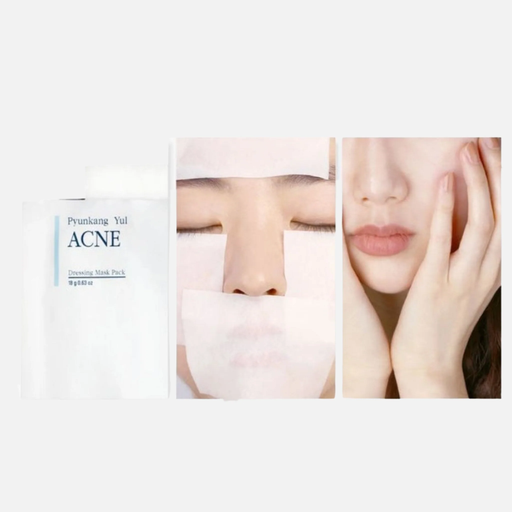 PYUNKANG YUL ACNE Facial Cleanser 120ml + Spot Patch + Acne Dressing Mask Set - Image 6