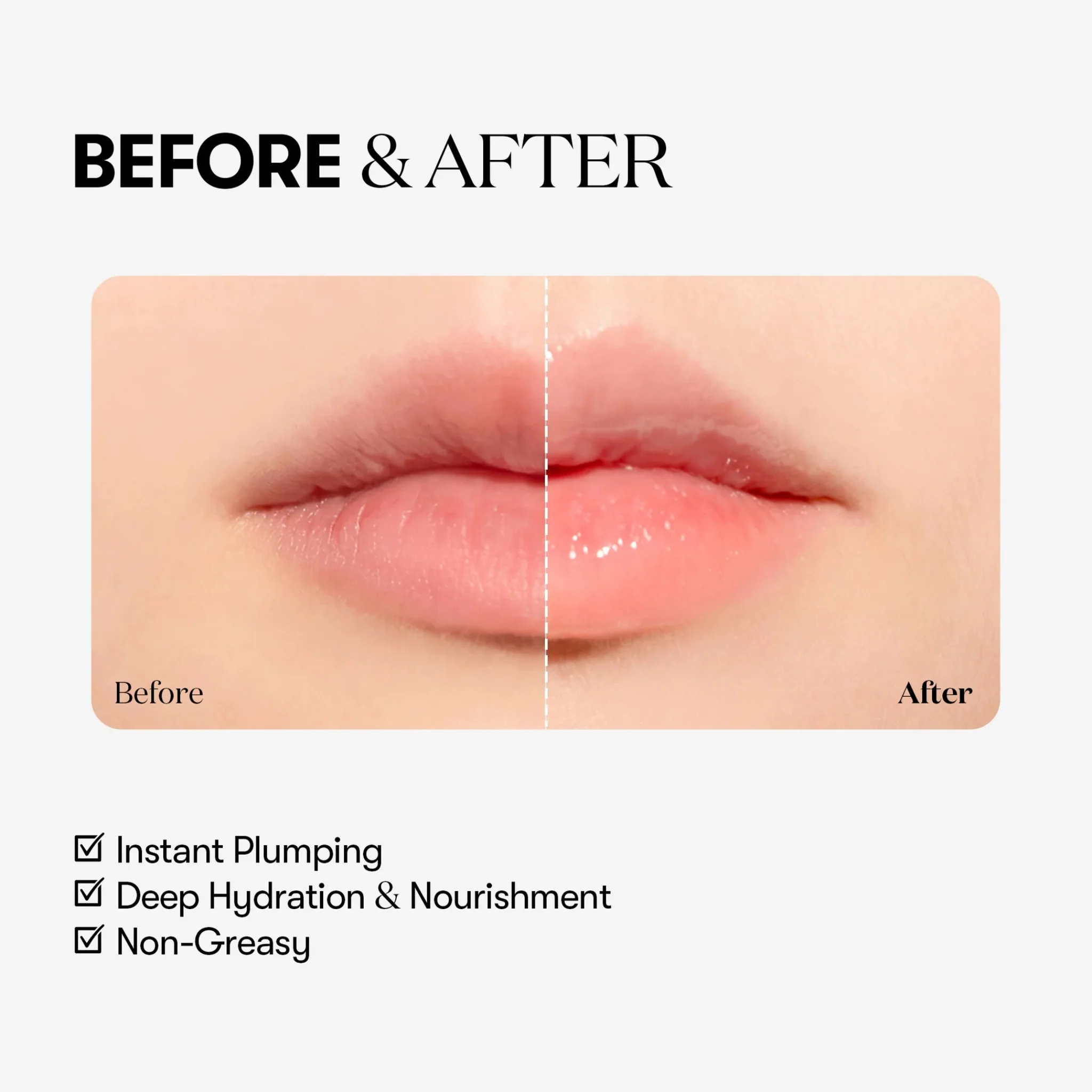 VT COSMETICS Reedle Shot Lip Plumper – Beginner - Image 4